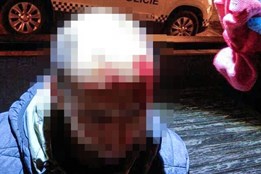 Strážníci v Plzni zachránili krvácejícího muže v Kopeckého sadech