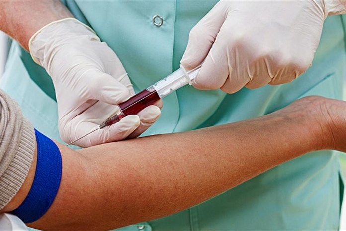 Největší transplantační centrum krvetvorných buněk v republice má plzeňská fakultní nemocnice