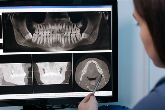 K zubaři radši dřív než později